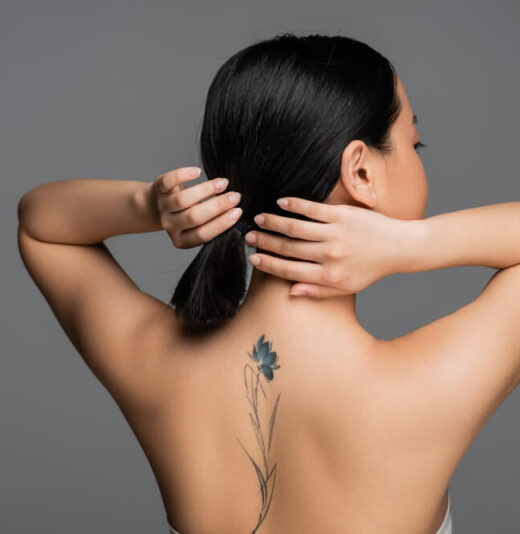 tattoo removal denver